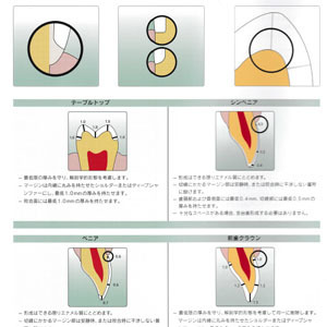 e.maxプレパレーションガイド